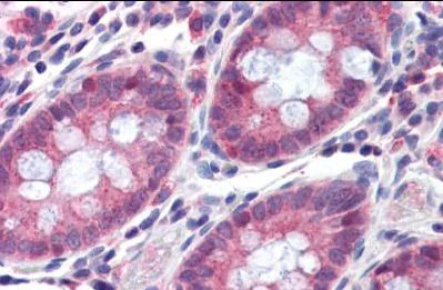 Immunohistochemistry (Formalin/PFA-fixed paraffin-embedded sections) - Anti-TMPRSS4 antibody (AB150595)