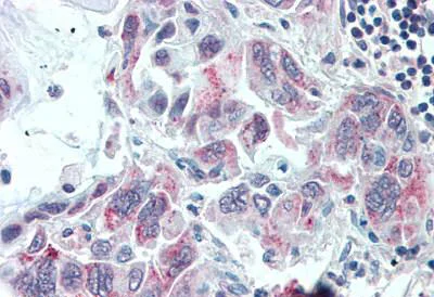 Immunohistochemistry (Formalin/PFA-fixed paraffin-embedded sections) - Anti-TMPRSS4 antibody (AB188816)