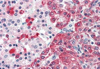 Immunohistochemistry (Formalin/PFA-fixed paraffin-embedded sections) - Anti-TMPRSS4 antibody (AB188816)