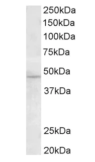 Western blot - Anti-TMPRSS4 antibody (AB82176)