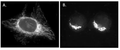 Immunocytochemistry/ Immunofluorescence - TMRE-Mitochondrial Membrane Potential Assay Kit (AB113852)