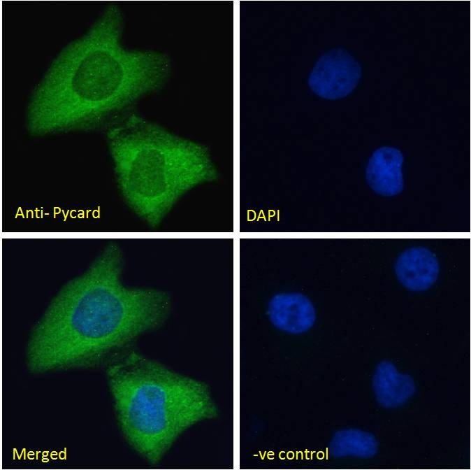 Immunocytochemistry/ Immunofluorescence - Anti-TMS1/ASC antibody (AB175449), expandable thumbnail