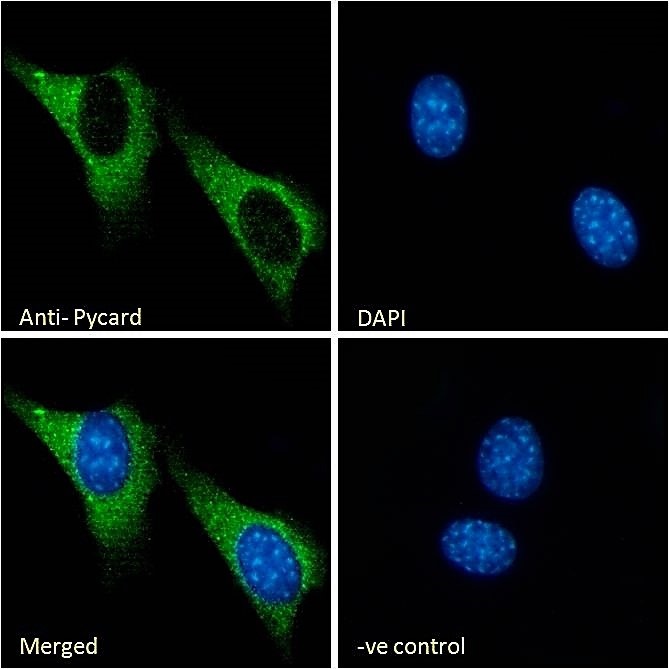 Immunocytochemistry/ Immunofluorescence - Anti-TMS1/ASC antibody (AB175449), expandable thumbnail