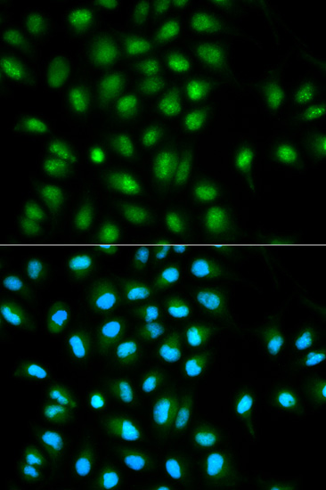 Immunocytochemistry/ Immunofluorescence - Anti-TMS1/ASC antibody (AB180799)