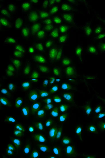 Immunocytochemistry/ Immunofluorescence - Anti-TMS1/ASC antibody (AB180799)