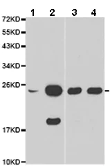 Western blot - Anti-TMS1/ASC antibody (AB180799)