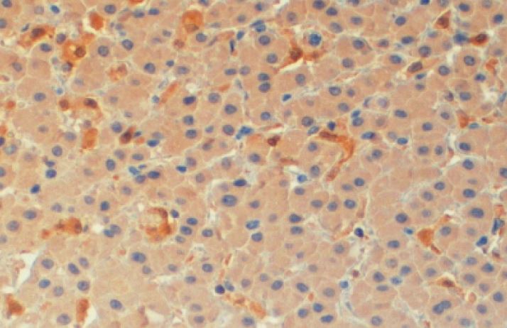 Immunohistochemistry (Formalin/PFA-fixed paraffin-embedded sections) - Anti-TMS1/ASC antibody (AB2236), expandable thumbnail