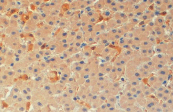 Immunohistochemistry (Formalin/PFA-fixed paraffin-embedded sections) - Anti-TMS1/ASC antibody (AB2236)
