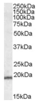 Western blot - Anti-TMS1/ASC antibody (AB2236)