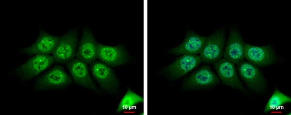 Immunocytochemistry/ Immunofluorescence - Anti-TMS1/ASC antibody (AB227502), expandable thumbnail