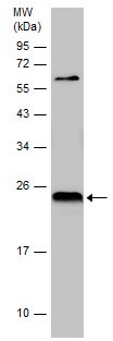 Western blot - Anti-TMS1/ASC antibody (AB227502), expandable thumbnail