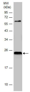 Western blot - Anti-TMS1/ASC antibody (AB227502)