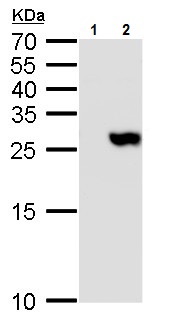 Western blot - Anti-TMS1/ASC antibody (AB227502), expandable thumbnail
