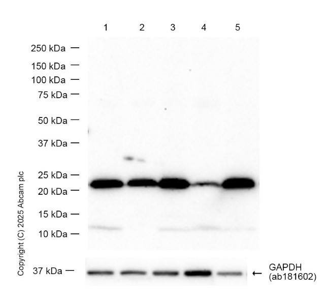 Western blot - Anti-TMS1/ASC antibody [EPR10402(B)] (AB151700), expandable thumbnail