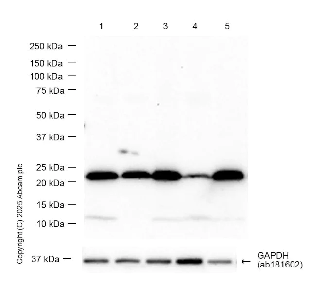 Western blot - Anti-TMS1/ASC antibody [EPR10402(B)] - BSA and Azide free (AB249023)
