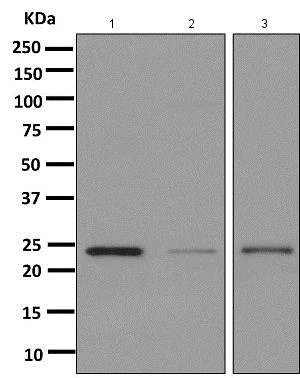 Western blot - Anti-TMS1/ASC antibody [EPR10402(B)] - BSA and Azide free (AB249023)