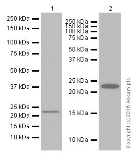 Western blot - Anti-TMS1/ASC antibody [EPR10403] (AB155970), expandable thumbnail
