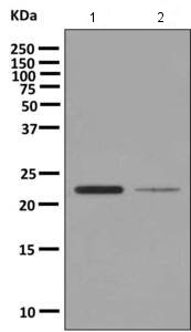 Western blot - Anti-TMS1/ASC antibody [EPR10403] (AB155970), expandable thumbnail