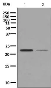 Western blot - Anti-TMS1/ASC antibody [EPR10403] (AB155970)