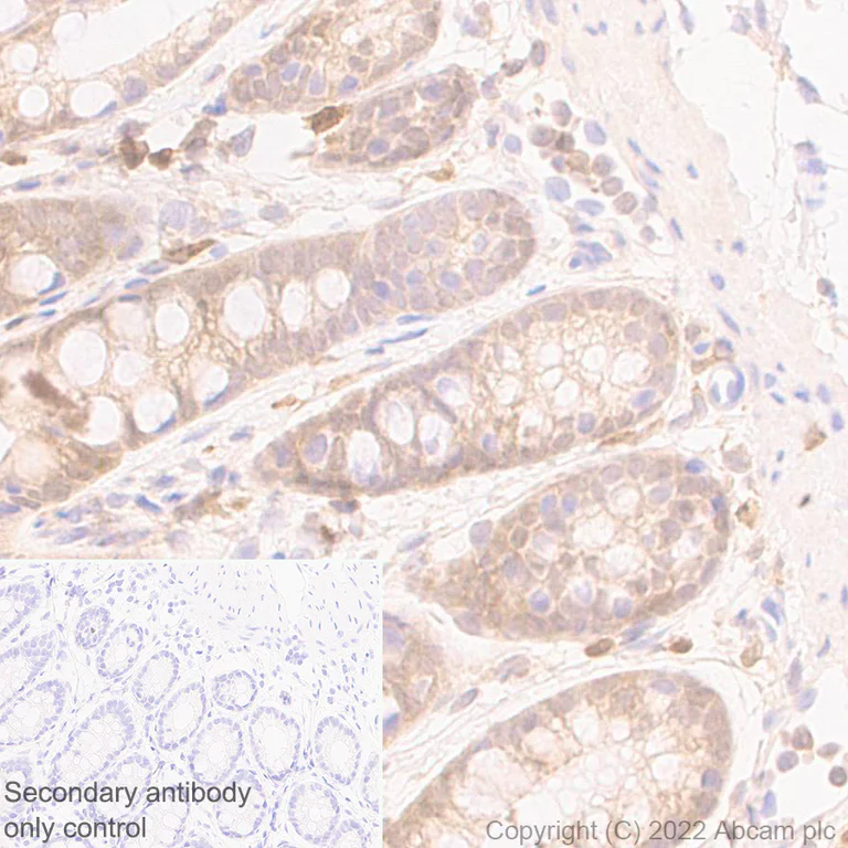 Immunohistochemistry (Formalin/PFA-fixed paraffin-embedded sections) - Anti-TMS1/ASC antibody [EPR28201-61] (AB307560)