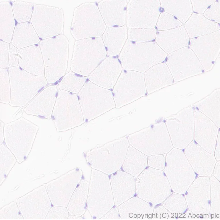 Immunohistochemistry (Formalin/PFA-fixed paraffin-embedded sections) - Anti-TMS1/ASC antibody [EPR28201-61] (AB307560)