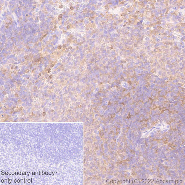 Immunohistochemistry (Formalin/PFA-fixed paraffin-embedded sections) - Anti-TMS1/ASC antibody [EPR28201-61] (AB307560)