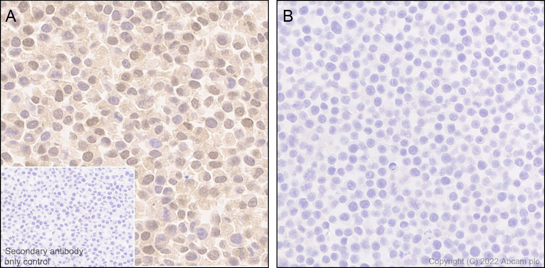 Immunohistochemistry (Formalin/PFA-fixed paraffin-embedded sections) - Anti-TMS1/ASC antibody [EPR28201-61] - BSA and Azide free (ab307561), expandable thumbnail