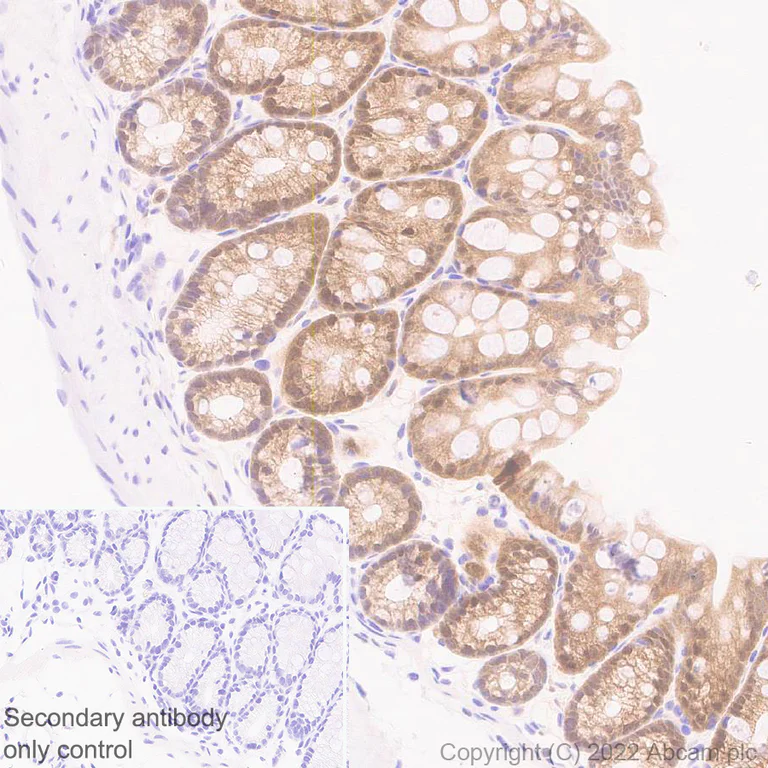 Immunohistochemistry (Formalin/PFA-fixed paraffin-embedded sections) - Anti-TMS1/ASC antibody [EPR28201-61] - BSA and Azide free (AB307561)