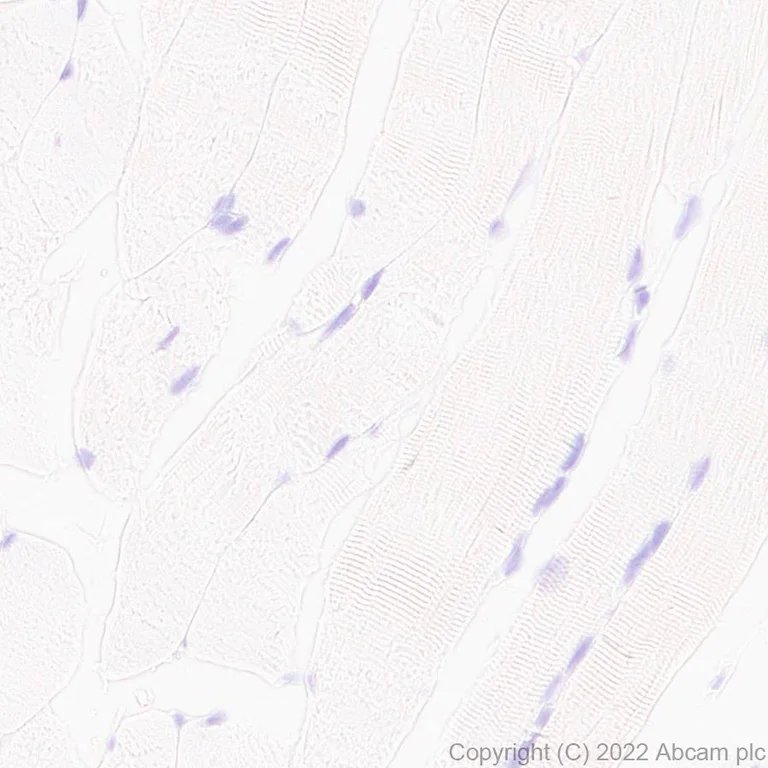 Immunohistochemistry (Formalin/PFA-fixed paraffin-embedded sections) - Anti-TMS1/ASC antibody [EPR28201-61] - BSA and Azide free (AB307561)