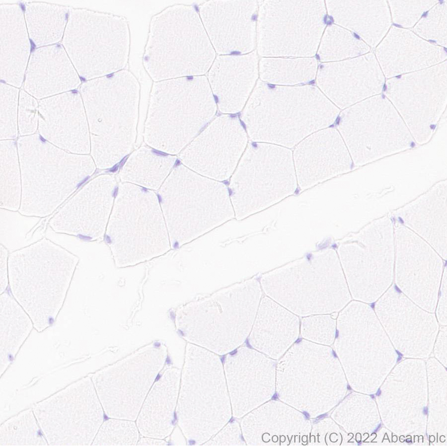 Immunohistochemistry (Formalin/PFA-fixed paraffin-embedded sections) - Anti-TMS1/ASC antibody [EPR28201-61] - BSA and Azide free (AB307561), expandable thumbnail