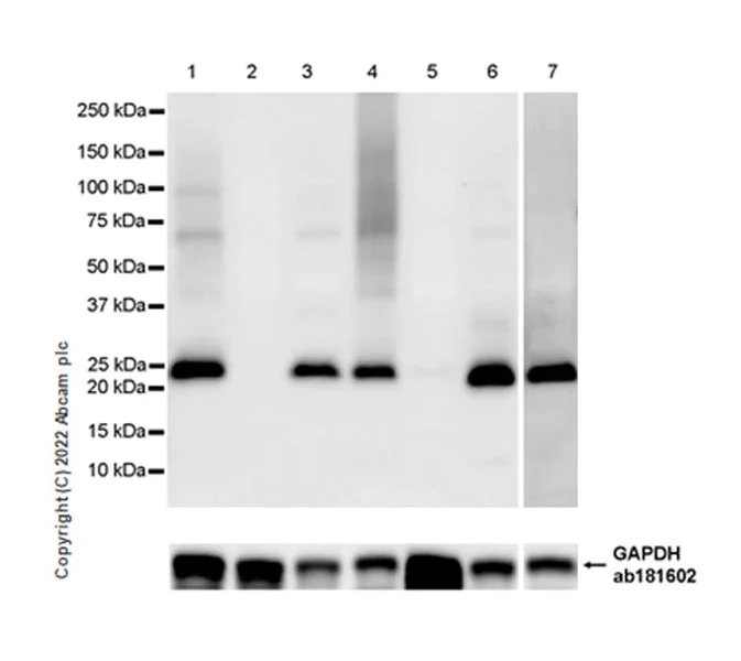 Western blot - Anti-TMS1/ASC antibody [EPR28201-61] - BSA and Azide free (AB307561)