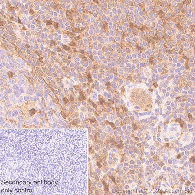 Immunohistochemistry (Formalin/PFA-fixed paraffin-embedded sections) - Anti-TMS1/ASC antibody [RM1049] (AB309497)