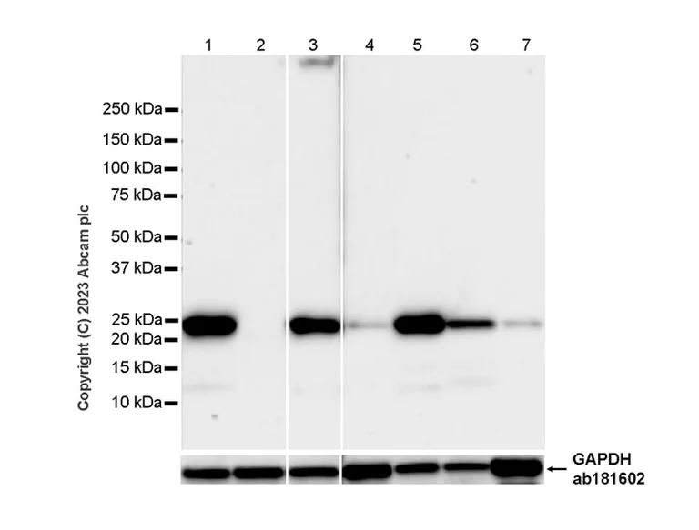 Western blot - Anti-TMS1/ASC antibody [RM1049] (AB309497)