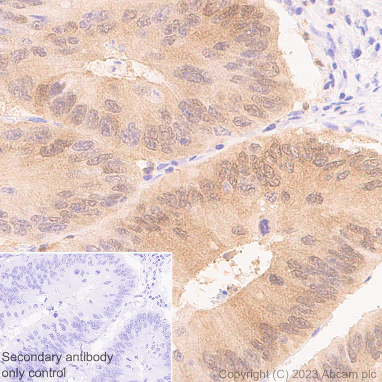 Immunohistochemistry (Formalin/PFA-fixed paraffin-embedded sections) - Anti-TMS1/ASC antibody [RM1049] - BSA and Azide free (AB309498)