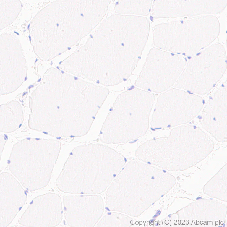 Immunohistochemistry (Formalin/PFA-fixed paraffin-embedded sections) - Anti-TMS1/ASC antibody [RM1049] - BSA and Azide free (AB309498)