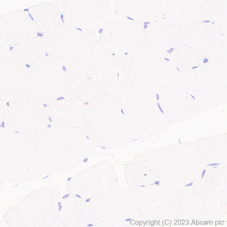 Immunohistochemistry (Formalin/PFA-fixed paraffin-embedded sections) - Anti-TMS1/ASC antibody [RM1049] - BSA and Azide free (ab309498), expandable thumbnail