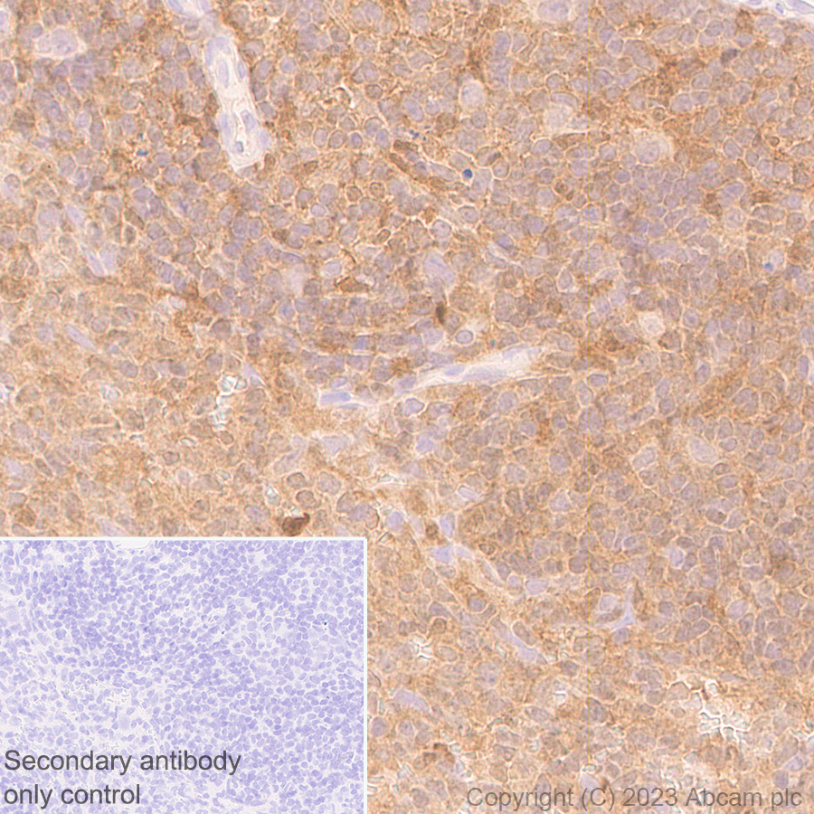 Immunohistochemistry (Formalin/PFA-fixed paraffin-embedded sections) - Anti-TMS1/ASC antibody [RM1049] - BSA and Azide free (ab309498), expandable thumbnail