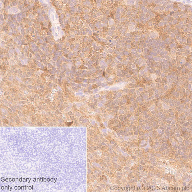 Immunohistochemistry (Formalin/PFA-fixed paraffin-embedded sections) - Anti-TMS1/ASC antibody [RM1049] - BSA and Azide free (AB309498)