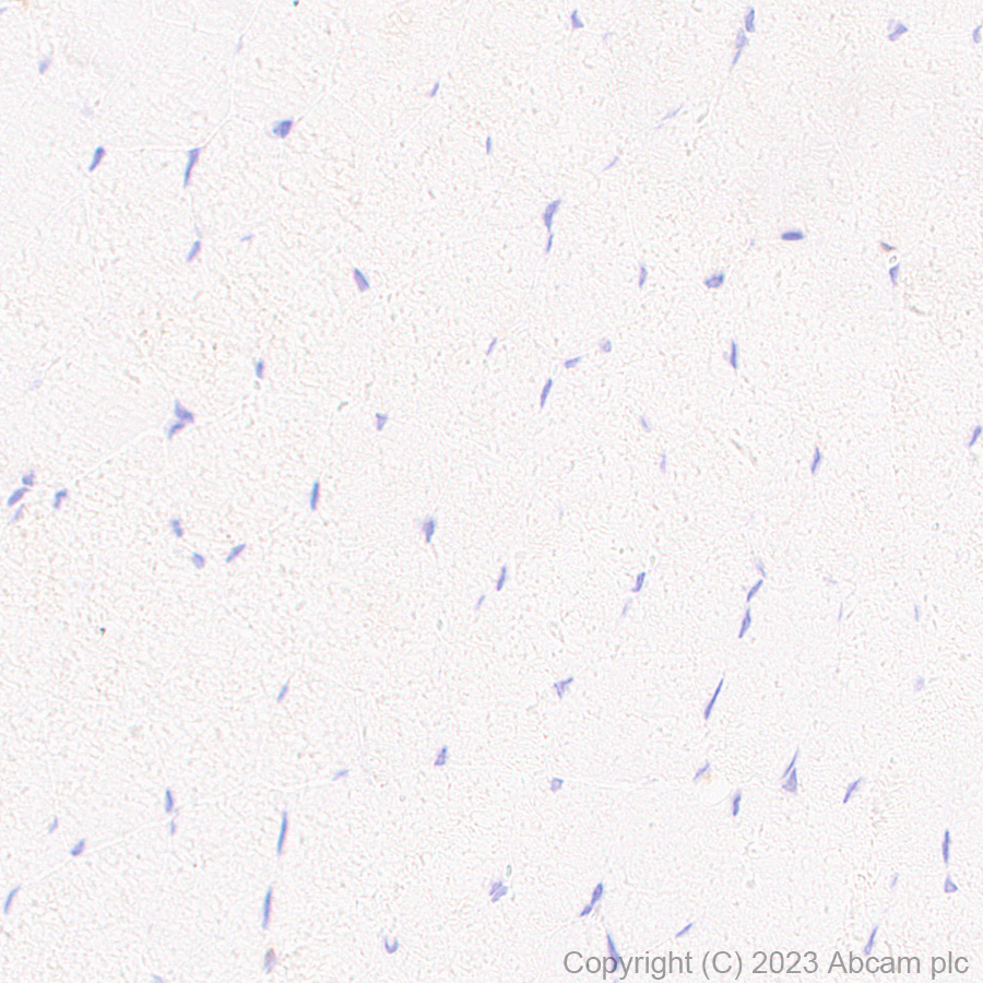Immunohistochemistry (Formalin/PFA-fixed paraffin-embedded sections) - Anti-TMS1/ASC antibody [RM1049] - BSA and Azide free (ab309498), expandable thumbnail