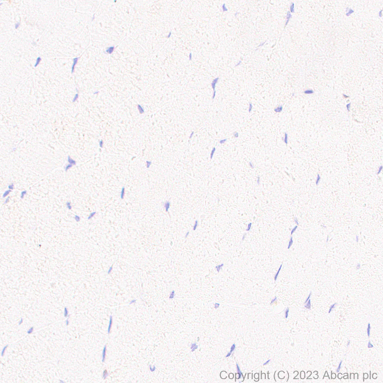 Immunohistochemistry (Formalin/PFA-fixed paraffin-embedded sections) - Anti-TMS1/ASC antibody [RM1049] - BSA and Azide free (AB309498)