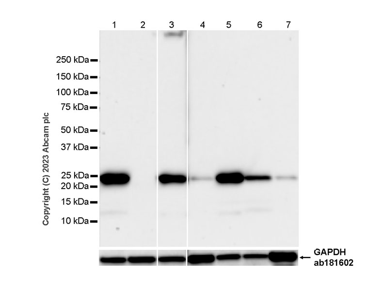 Western blot - Anti-TMS1/ASC antibody [RM1049] - BSA and Azide free (AB309498), expandable thumbnail