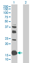 Western blot - TMS1/ASC overexpression 293T lysate (whole cell) (AB94128)