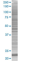 TMS1 overexpression 293T lysate (whole cell)