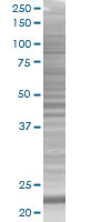 SDS-PAGE - TMS1 overexpression 293T lysate (whole cell) (AB94129)