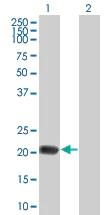 Western blot - TMS1 overexpression 293T lysate (whole cell) (AB94129)