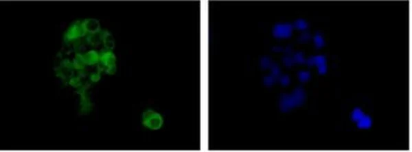 Immunocytochemistry/ Immunofluorescence - Anti-TMUB1 antibody [EPR14066] - BSA and Azide free (AB250234)