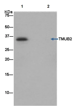 Immunoprecipitation - Anti-TMUB2 antibody [EPR13741] (AB181183)