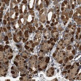 Immunohistochemistry (Formalin/PFA-fixed paraffin-embedded sections) - Anti-TMX3 antibody (AB121414)