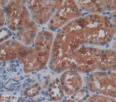 Immunohistochemistry (Formalin/PFA-fixed paraffin-embedded sections) - Anti-TN-X antibody (AB233231)