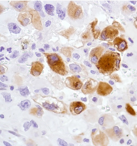 Immunohistochemistry (Formalin/PFA-fixed paraffin-embedded sections) - Anti-TN-X antibody [SP230] - BSA and Azide free (AB271942)
